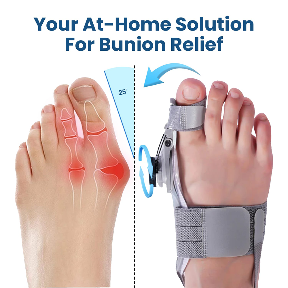 🔥50% OFF🔥 🦶 Adjustable Bunion Corrector Toe Separator (Day & Night Use) ✨